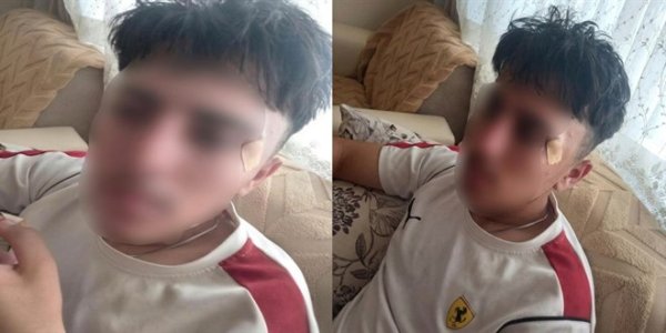 'Öğretmen, öğrenciye kafa attı' iddiası: Savcılık soruşturma başlattı